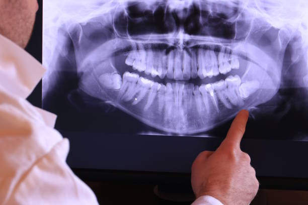 Best Emergency Broken Tooth Repair in Overlea, MD